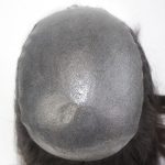 Inyectado Normal(Inyectado plano) Prótesis Capilar Personalizada Femenina | New Times Hair